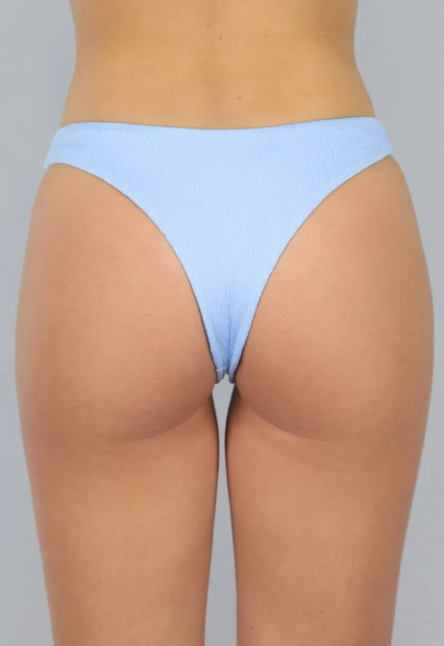 Lichtblauw Cheeky Bikini Broekje met Structuur